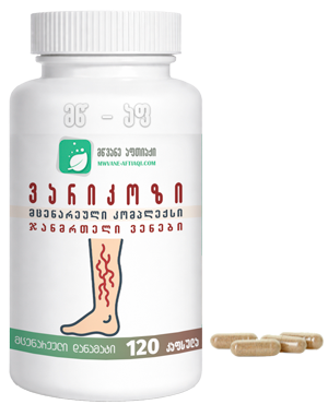 ვარიკოზის  კომპლექსი